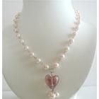 Under5Static/UNE125.html